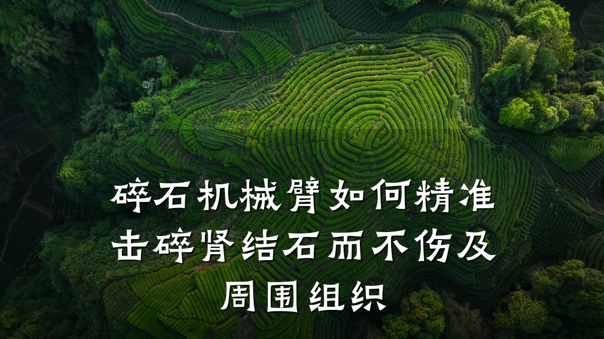 碎石机械臂如何精准击碎肾结石而不伤及周围组织